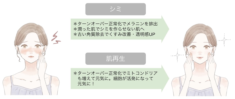 水光プラズマフェイシャルの効果③