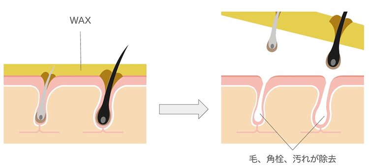 WAX脱毛はうぶ毛も含めた毛と角栓や汚れも一緒に除去されます