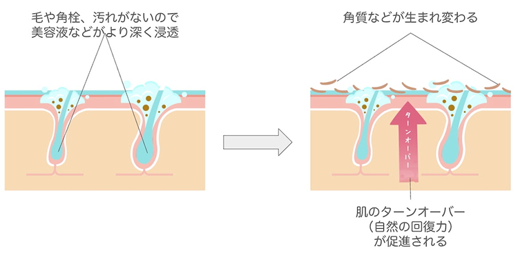 WAX脱毛でうぶ毛も含めた毛、角栓や汚れがなくなったお肌に
美容液を使用するとその効果が高まる。