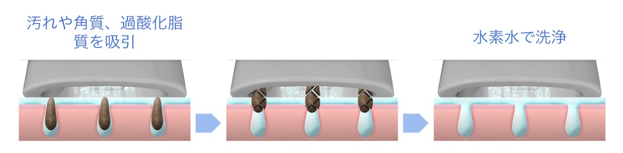 ハイドロスプラッシュのメカニズム