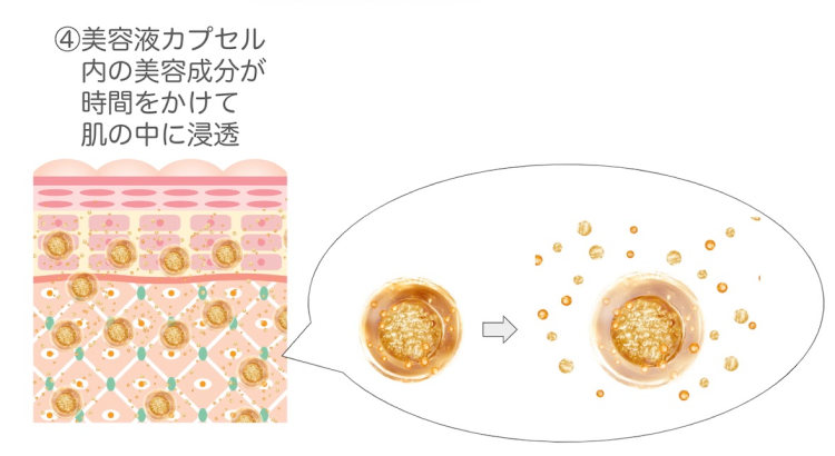 水光プラズマフェイシャルの仕組み②